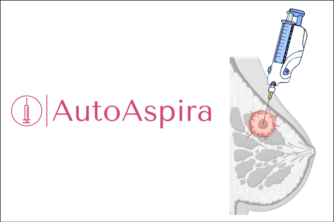 Cross-sectional view of AutoAspira’s handheld device in use, during breast Fine Needle Aspiration (FNA). Our solution improves mass and cellularity of samples compared to manual FNA, by optimizing combinations of automated motion modalities.