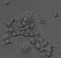 CAR-Macrophage Phagocytosing Cancer Cells