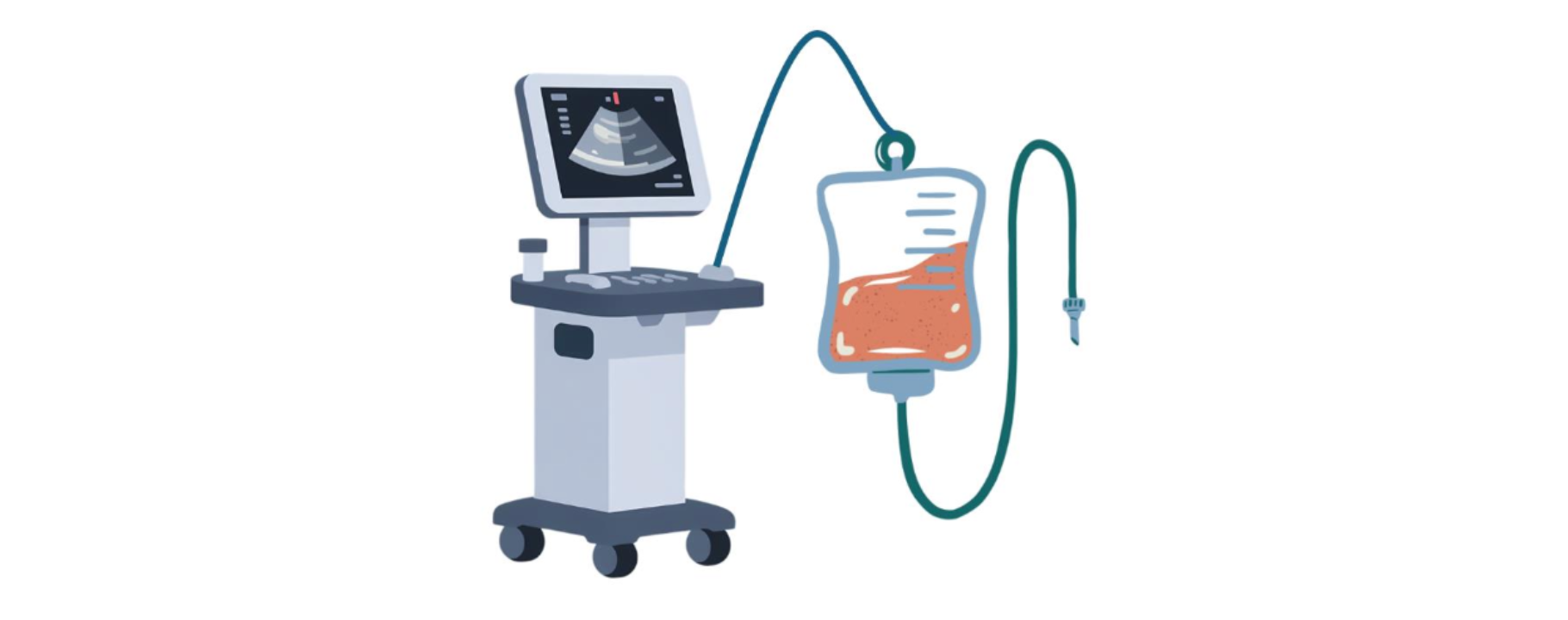 Illustration of an ultrasound machine on wheels beside an IV fluid bag with tubing, representing ultrasound-guided IV care equipment.