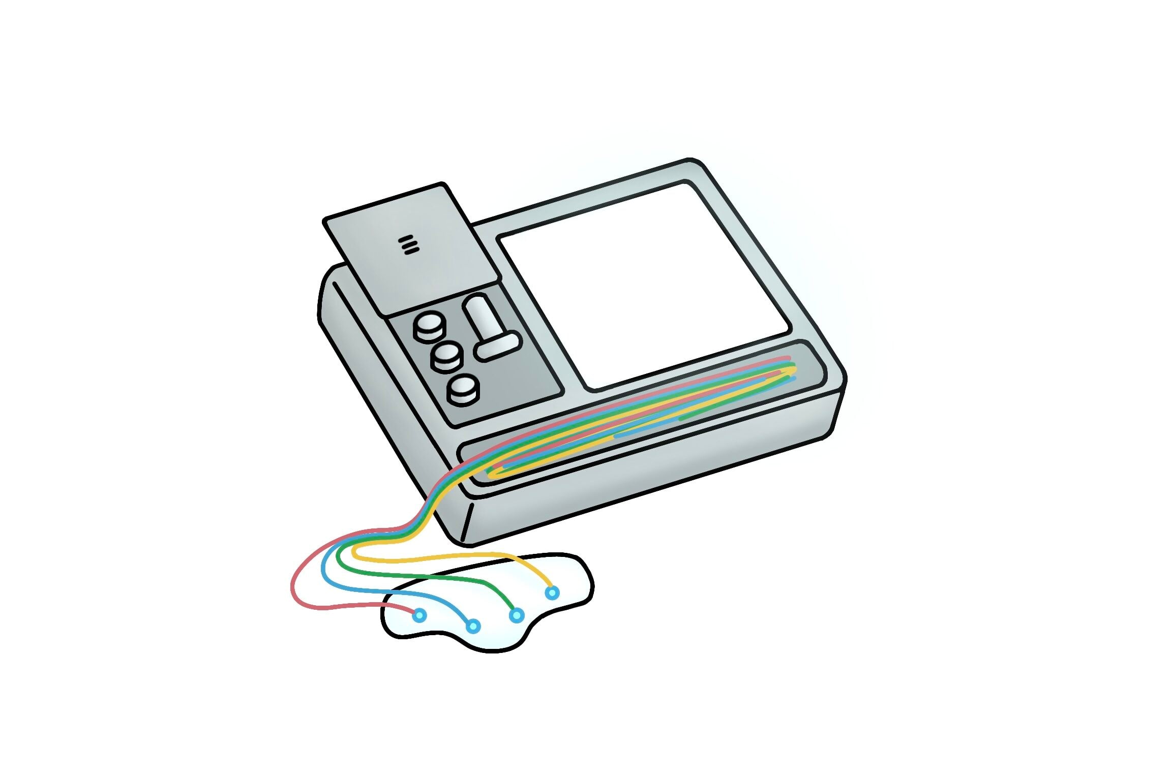 The electrobulbogram system includes an adhesive forehead patch equipped with electrodes, a signal acquisition device, and a smell dispenser. During the assessment, the device captures electrical signals from the olfactory bulb as the patient is exposed to three distinct odors.