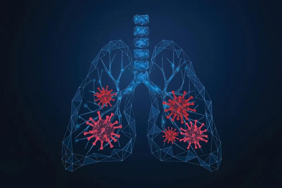 AI Can Now Detect COVID19 in Lung Ultrasounds Department of