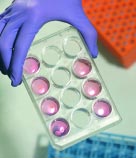 Derived from the bone marrow of goats, adult stem cells such as these might be coaxed to produce cartilage and a type of bone. The cells in these vials are encased in hydrogel and surrounded with a culture medium (the orange part).
