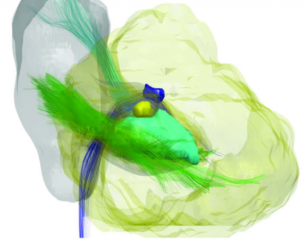 Brain Imaging