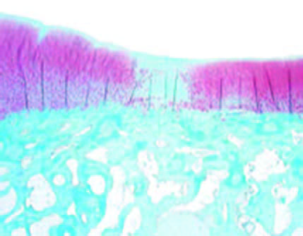 Researchers are making synthetic scaffolds to create cartilage that will bond better to the body’s natural cartilage.