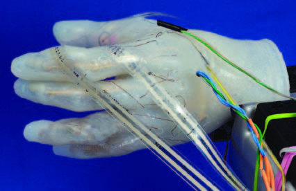 The next generation of prosthetics are neurally controlled, can “feel” temperature, and sense pressure.