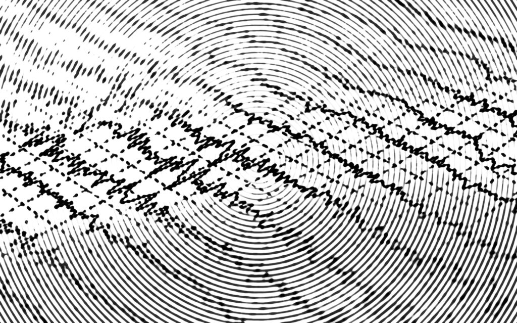 Brain wave on electroencephalogram EEG for epilepsy