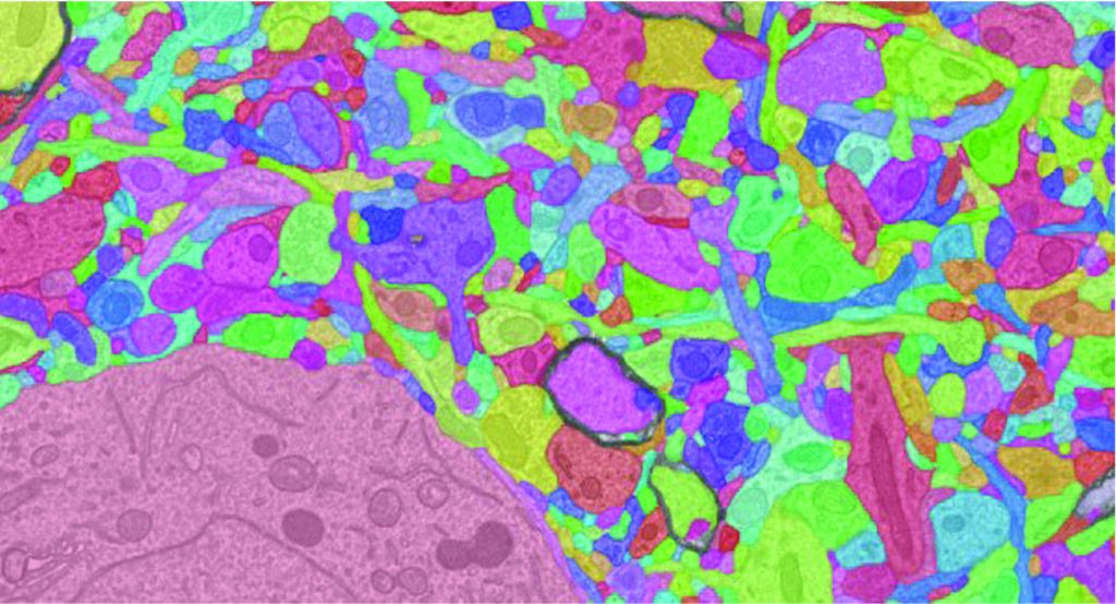 Up=close colorful photo of brain cells.