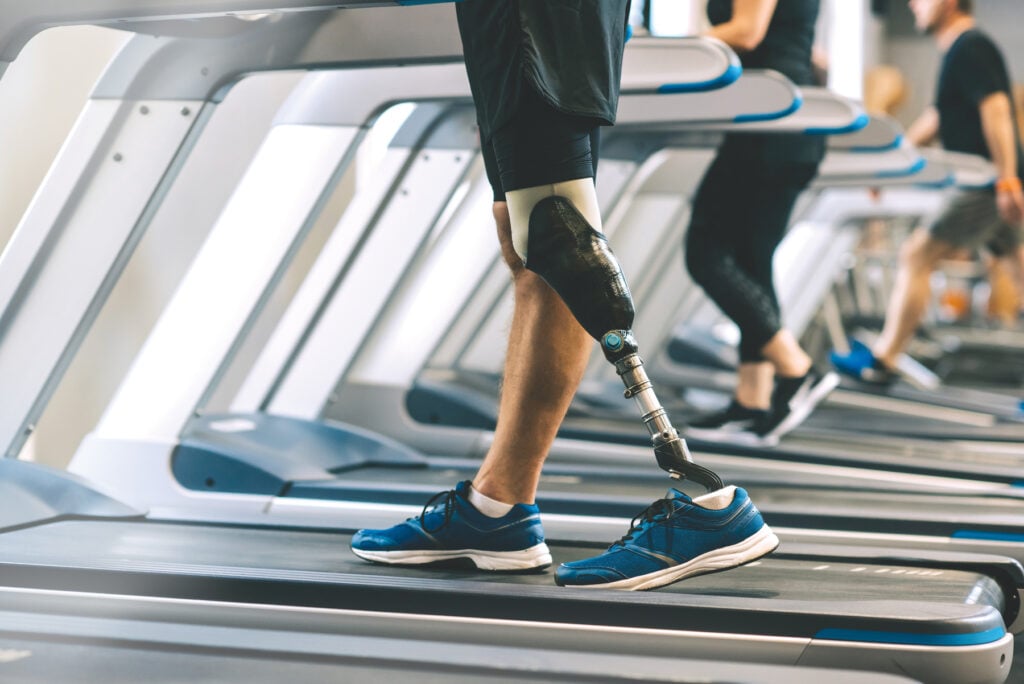 Cropped shot of man with artificial leg walking on treadmills at gym with other people