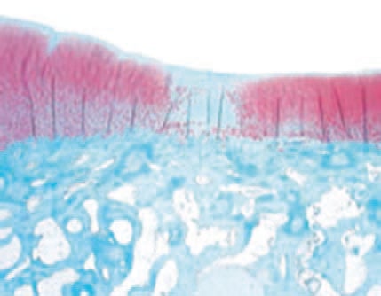 Researchers are making synthetic scaffolds to create cartilage that will bond better to the body’s natural cartilage.