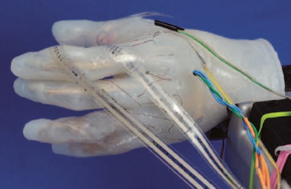 The next generation of prosthetics are neurally controlled, can “feel” temperature, and sense pressure.