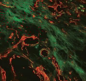 Mimetic peptides bind with collagen proteins to create modified collagen that could help prevent the formation of scar tissue.