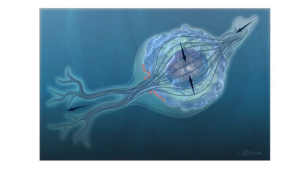Illustration of cells demonstrating cancer's spread
