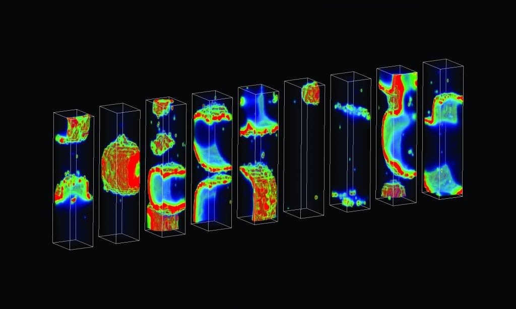 Arrhythmia illustration