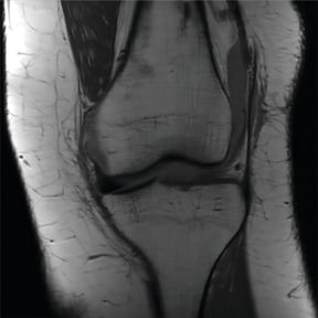 MRI scan using Wang's algorithm