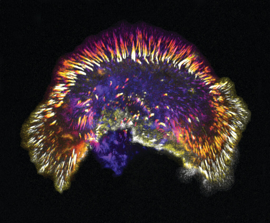 Colorful image of cells titled "Focal Adhesion Fireworks".