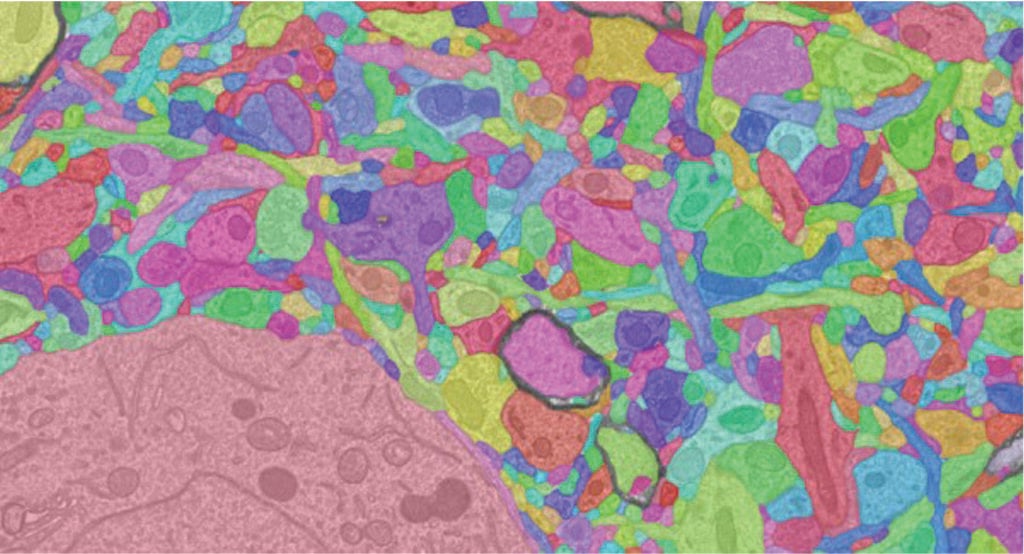 Up=close colorful photo of brain cells.
