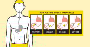Yellow diagram of how posture affects taking pills.