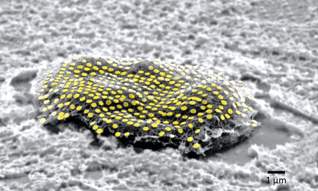microscopic image of gold dots on a cell