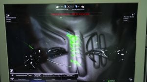 photo of glowing sutures