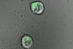 Microscopic view of T-cells that have a pinch of green color, interacting with transparent gel.