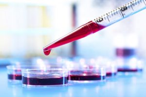 Blood dripping from the syringe into the sample collectors.