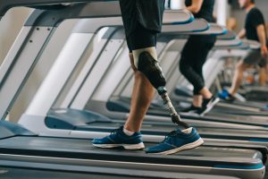 A person with a prosthetic left leg walks on a treadmill. The photo is taken from the waist down. In the background are other people on treadmills.