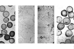 Four black and white photos of cells.