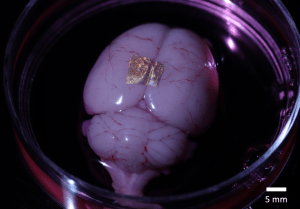 Gold nanowire array on a rat brain.