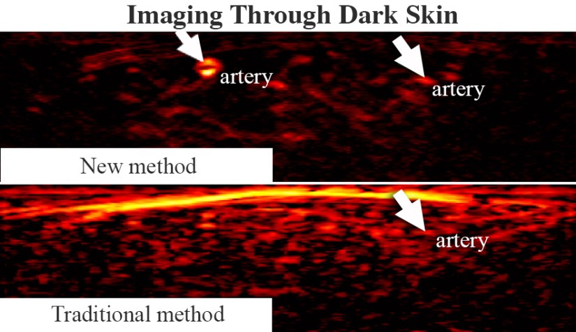 A comparison image showing "Imaging Through Dark Skin" with "New Method" vs "Old Method." Arteries, shown in red, are much easier to see in the new method. 