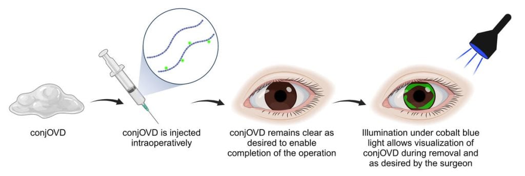 A diagram of conjOVD being used in the eye