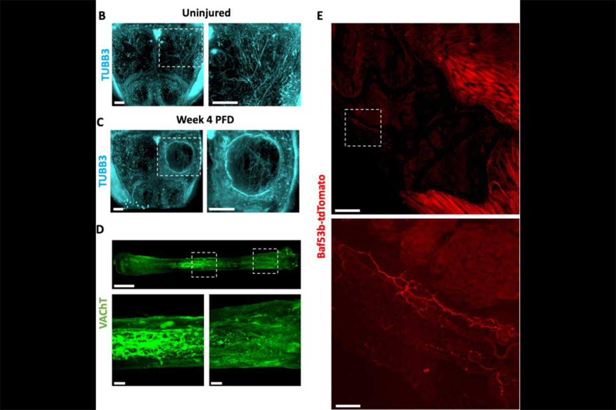 Composite figure illustrating nerves in mouse bone samples imaged with fluorescent microscopy. Panels show uninjured and healing skull bone with visible nerve fibers, a metatarsal bone with fine autonomic nerve structures, and a knee joint cross-section showing peripheral nerves along bone surfaces and nearby tissue. The images demonstrate how the method captures detailed 3D nerve patterns in different skeletal regions.