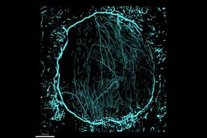 An X-ray of nerves in a skull, highlighted in blue with a black background
