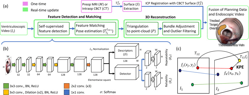 Multi-part diagram showing a processing pipeline: endoscopic video input, neural-network-based feature detection, feature matching between frames, triangulation into a 3D point cloud, and overlay of planned anatomical targets onto the live endoscopic video