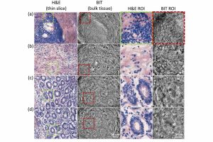 Side-by-side microscope images comparing stained tissue sections and unstained tissue imaged with Back-Illumination Tomography. The left images show conventional H&E-stained pancreas and duodenum tissue, while the right images show adjacent unprocessed tissue with visible cellular and structural features using reflected light.